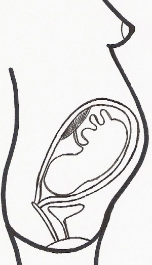 semana de embarazo 31
